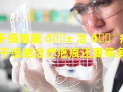 干细胞能 🐱 治 🐴 疗刀疤吗（干细胞治疗疤痕还要等多久）